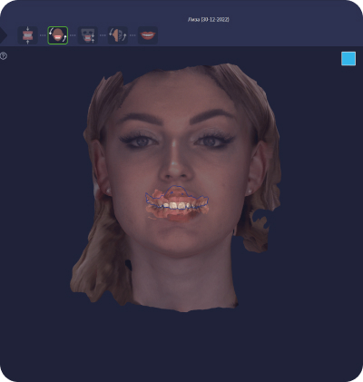 Автоматическое определение положения на основе AI.jpg Автоматическое определение положения на основе AI.jpg